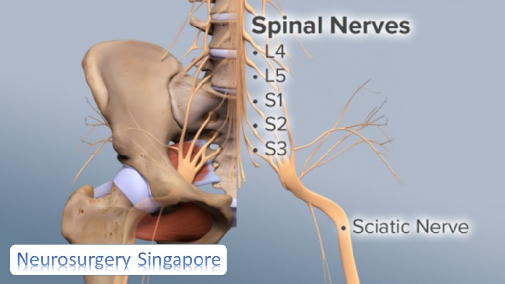 Sciatica nerve pain main