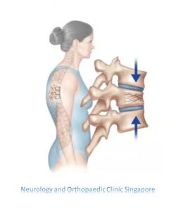 Spinal Compression Fracture info