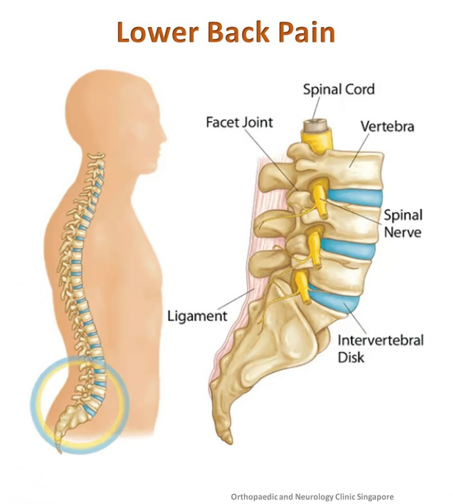 Lower Back Pain info 2